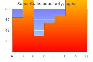 buy 80 mg super cialis fast delivery