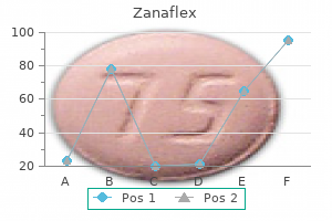 order zanaflex with a mastercard