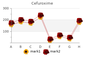 order cefuroxime 250 mg with amex