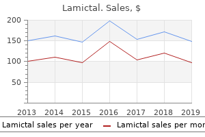 buy cheap lamictal 25mg online