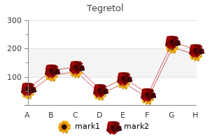 buy tegretol 100 mg low price