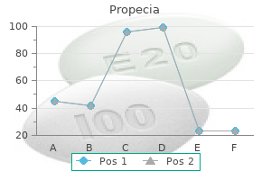 cheap propecia 5 mg with amex