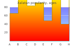 order xalatan master card