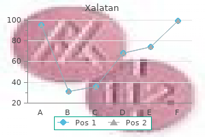 order genuine xalatan online