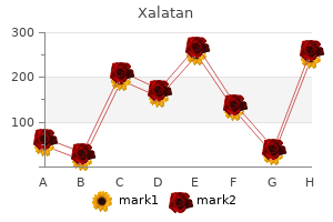 best buy for xalatan