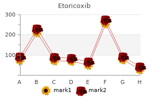 order cheapest etoricoxib and etoricoxib