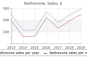 cheap 50mg naltrexone with mastercard