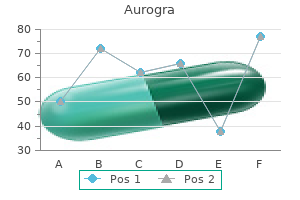 buy aurogra on line amex