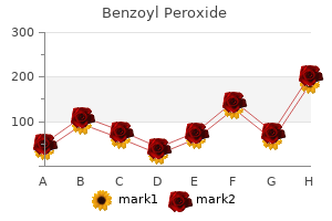 order benzoyl 20gr on line