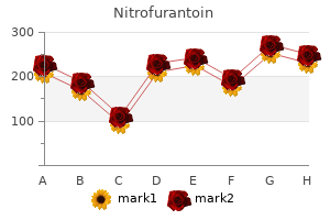 order 100mg nitrofurantoin fast delivery