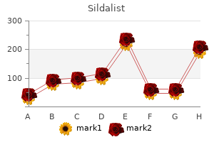 order 120mg sildalist with mastercard
