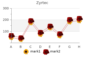 buy 10mg zyrtec otc